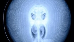 Ultraculture | This Is an X-Ray Picture of a Stingray